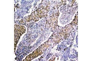 IHC analysis of LRTOMT using anti-LRTOMT antibody (ABIN7602986). (Leucine Rich Transmembrane and 0-Methyltransferase Domain Containing (LRTOMT) (Middle Region) anticorps)