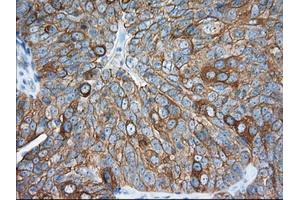 Immunohistochemistry (IHC) image for anti-Transforming, Acidic Coiled-Coil Containing Protein 3 (TACC3) antibody (ABIN1498098) (TACC3 anticorps)