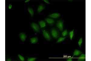 Immunofluorescence of monoclonal antibody to RP6-213H19.