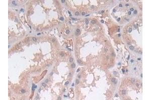 Detection of SRY in Human Kidney Tissue using Polyclonal Antibody to Sex Determining Region Y (SRY) (SRY anticorps  (AA 1-204))