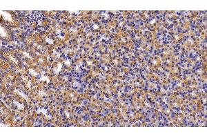 Detection of KRT6A in Rat Stomach Tissue using Polyclonal Antibody to Keratin 6A (KRT6A)