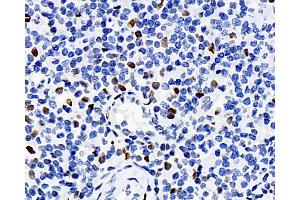 Immunohistochemistry analysis of paraffin-embedded human tonsil using ERK 2 Polyclonal Antibody at dilution of 1:100. (ERK2 anticorps)