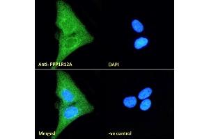 (ABIN6391349) Immunofluorescence analysis of paraformaldehyde fixed U2OS cells, permeabilized with 0. (PPP1R12A anticorps  (C-Term))