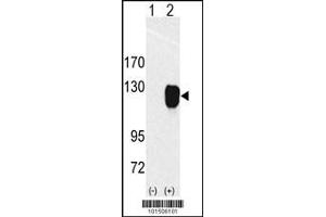 Western blot analysis of ROR1 using rabbit polyclonal ROR1 Antibody using 293 cell lysates (2 ug/lane) either nontransfected (Lane 1) or transiently transfected with the ROR1 gene (Lane 2).