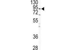 Western blot analysis of IKK beta antibody and HeLa lysate.