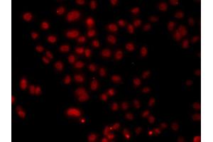 Immunofluorescence analysis of A549 cell using HNRNPA1 antibody. (HNRNPA1 anticorps)