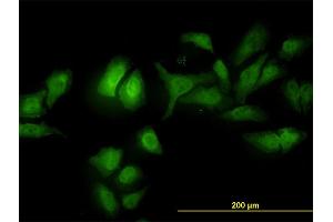 Immunofluorescence of monoclonal antibody to ADRM1 on HeLa cell.