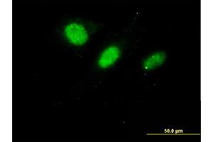 Immunofluorescence of monoclonal antibody to DNAJC7 on HeLa cell.