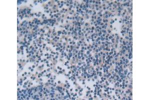 IHC-P analysis of lymph node tissue, with DAB staining. (NCR1 anticorps  (AA 17-211))