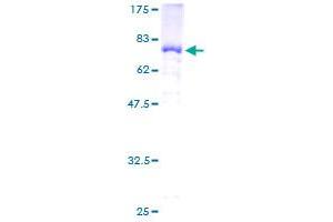 Image no. 1 for Transcription Factor AP-2 beta (Activating Enhancer Binding Protein 2 Beta) (TFAP2B) (AA 1-449) protein (GST tag) (ABIN1322525) (TFAP2B Protein (AA 1-449) (GST tag))