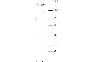 AIB1 antibody (pAb) tested by Western blot. (NCOA3 anticorps)