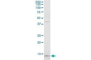 PFN1 polyclonal antibody (A01), Lot # Abnova060427QCS1. (PFN1 anticorps  (AA 1-140))