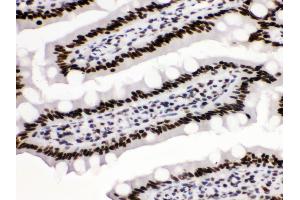 Anti-KAP1 Picoband antibody, IHC(P) IHC(P): Rat Intestine Tissue
