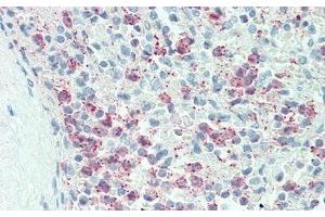 anti-Interleukin 17 Receptor C (IL17RC) (AA 73-330) antibody