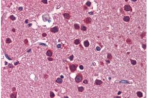 Human Brain, Cortex: Formalin-Fixed, Paraffin-Embedded (FFPE)