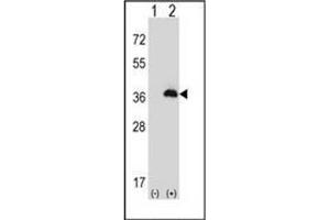 Western blot analysis of PEX16 (arrow) using Peroxin 16 / PEX16 Antibody (Center) Cat. (PEX16 anticorps  (Middle Region))