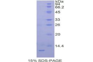 SDS-PAGE analysis of Human PRAME Protein.