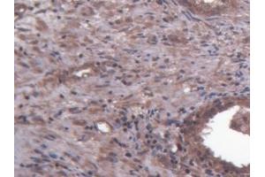 Detection of HSPG in Human Prostate Tissue using Polyclonal Antibody to Heparan Sulfate Proteoglycan (HSPG)