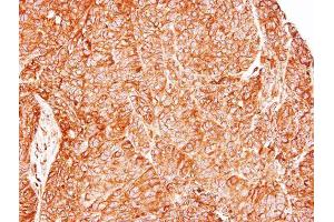 IHC-P Image Immunohistochemical analysis of paraffin-embedded DLD1 xenograft, using TC21, antibody at 1:500 dilution.