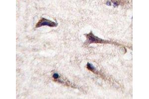 IHC analysis of FFPE human brain tissue stained with PKC beta 2 antibody