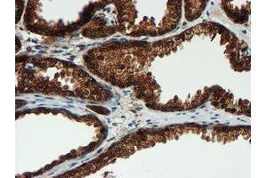 Image no. 3 for anti-Proteasome Subunit alpha 6 (PSMA6) antibody (ABIN1500464)