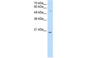 CHIC2 antibody used at 0. (CHIC2 anticorps  (N-Term))