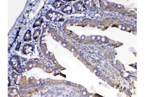 IHC analysis of Flt3 / CD135 using anti-Flt3 / CD135 antibody .