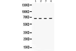 Anti- STXBP2 Picoband antibody, Western blottingAll lanes: Anti STXBP2  at 0. (STXBP2 anticorps  (N-Term))