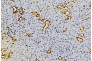 ABIN6279731 at 1/100 staining Mouse kidney tissue by IHC-P. (RAB22A anticorps  (C-Term))