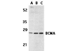 Western Blotting (WB) image for anti-Tumor Necrosis Factor Receptor Superfamily, Member 17 (TNFRSF17) (C-Term) antibody (ABIN1030288) (BCMA anticorps  (C-Term))
