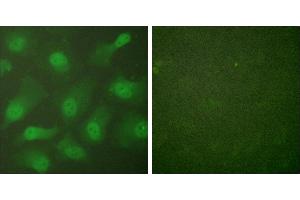 Forskolin + -Immunofluorescence analysis of HeLa cells, treated with Forskolin (40nM, 30mins), using CSantibody. (Exportin 2 anticorps)