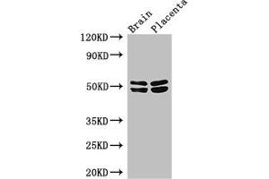 Western Blot Positive WB detected in: Mouse brain tissue, Human placenta tissue All lanes: ADRB1 antibody at 3 μg/mL Secondary Goat polyclonal to rabbit IgG at 1/50000 dilution Predicted band size: 52 kDa Observed band size: 52, 48 kDa