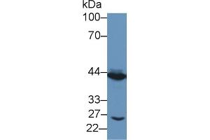 Detection of TACR2 in Porcine Small intestine lysate using Polyclonal Antibody to Tachykinin Receptor 2 (TACR2)