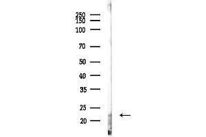 anti-Triggering Receptor Expressed On Myeloid Cells 5 (TREM5) (C-Term) antibody