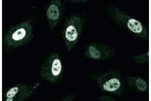 Immunofluorescence staining of human endothelial cells.