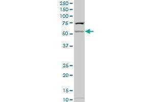 CHST2 polyclonal antibody (A01), Lot # 060524JCS1 Western Blot analysis of CHST2 expression in HepG2 .