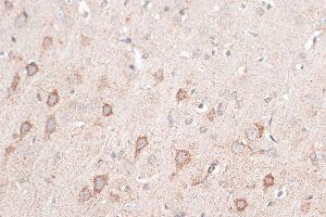Immunohistochemistry of paraffin-embedded rat brain using CD274 Antibody (ABIN6291806) at dilution of 1:100 (40x lens). (PD-L1 anticorps)