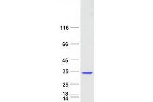 Validation with Western Blot
