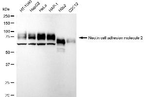 Western blotting analysis using Nectin cell adhesion molecule 2 antibody (ABIN7799565). (Recombinant Nectin-2 anticorps)