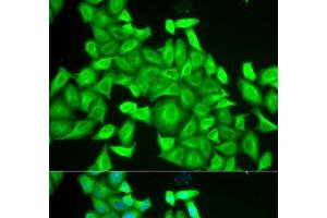 Immunofluorescence analysis of HeLa cells using RAB6A Polyclonal Antibody (RAB6A anticorps)