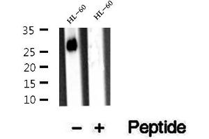 Western blot analysis of extracts of HL-60 cells, using ARHGDIB antibody. (ARHGDIB anticorps  (N-Term))