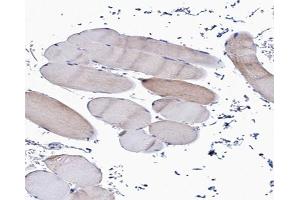 ABIN6266880 at 1/100 staining human Skeletal muscle tissue sections by IHC-P.