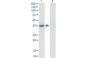 Western Blot analysis of SUGT1 expression in transfected 293T cell line by SUGT1 monoclonal antibody (M04), clone 1A10.