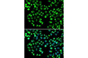 Immunofluorescence analysis of MCF7 cell using GRM4 antibody. (Metabotropic Glutamate Receptor 4 anticorps)
