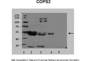 Sample Type: 1. (COPS2 anticorps  (N-Term))