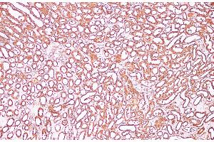 Immunohistochemistry of paraffin-embedded Human kidney using CDK4 Polyclonal Antibody at dilution of 1:100 (CDK4 anticorps)