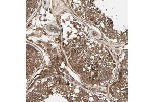 Immunohistochemical staining (Formalin-fixed paraffin-embedded sections) of human testis with FKBP15 polyclonal antibody  shows strong cytoplasmic positivity in cells in seminiferous ducts and Leydig cells.