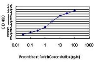Detection limit for recombinant GST tagged PIK3R4 is approximately 0. (PIK3R4 anticorps  (AA 1259-1358))