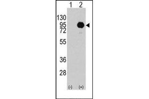 Image no. 1 for anti-B-Raf proto-oncogene, serine/threonine kinase (BRAF) (Ser445) antibody (ABIN360132)