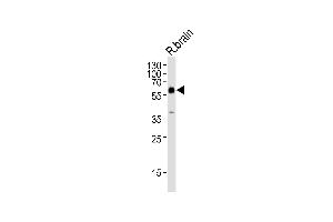 Western blot analysis of lysate from rat brain tissue lysate, using GAD2 Antibody (Center) (ABIN655070 and ABIN2844700).